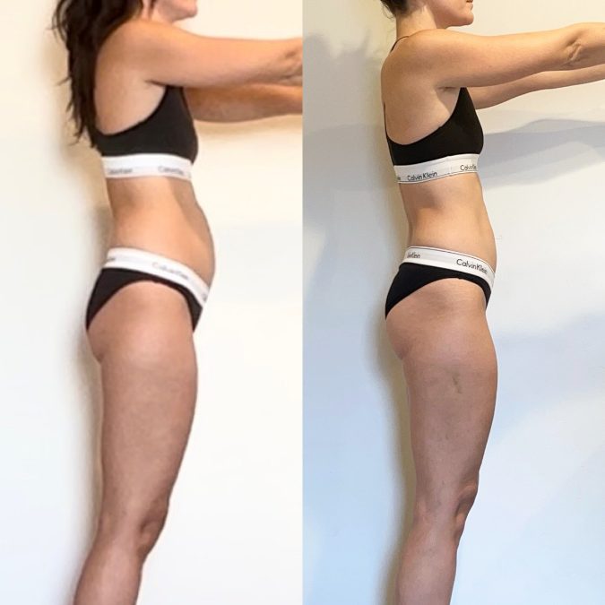 Amber transformation